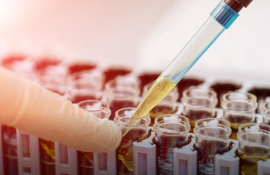 Golden Batch Analysis